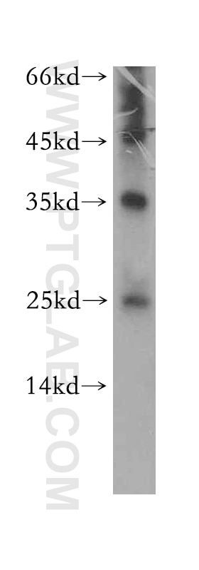 Western Blot (WB) analysis of mouse pancreas tissue using ADAT2 Polyclonal antibody (13621-1-AP)