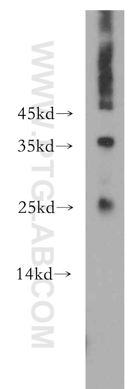 Western Blot (WB) analysis of A431 cells using ADAT2 Polyclonal antibody (13621-1-AP)
