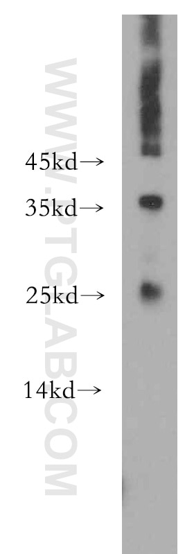 Western Blot (WB) analysis of A431 cells using ADAT2 Polyclonal antibody (13621-1-AP)