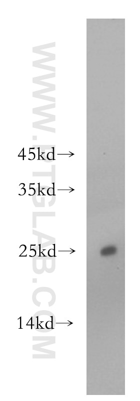 Western Blot (WB) analysis of mouse brain tissue using ADAT2 Polyclonal antibody (13621-1-AP)