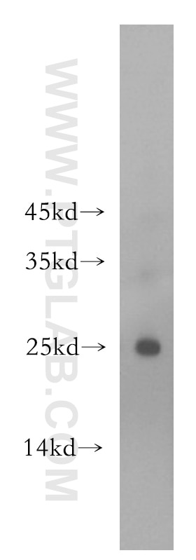 Western Blot (WB) analysis of mouse brain tissue using ADAT2 Polyclonal antibody (13621-1-AP)