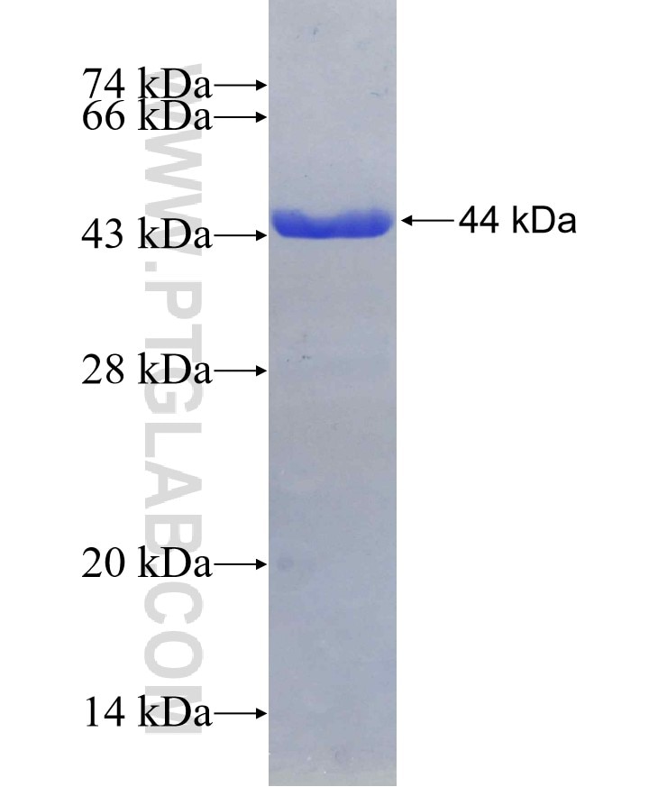 ADAT2 fusion protein Ag4529 SDS-PAGE