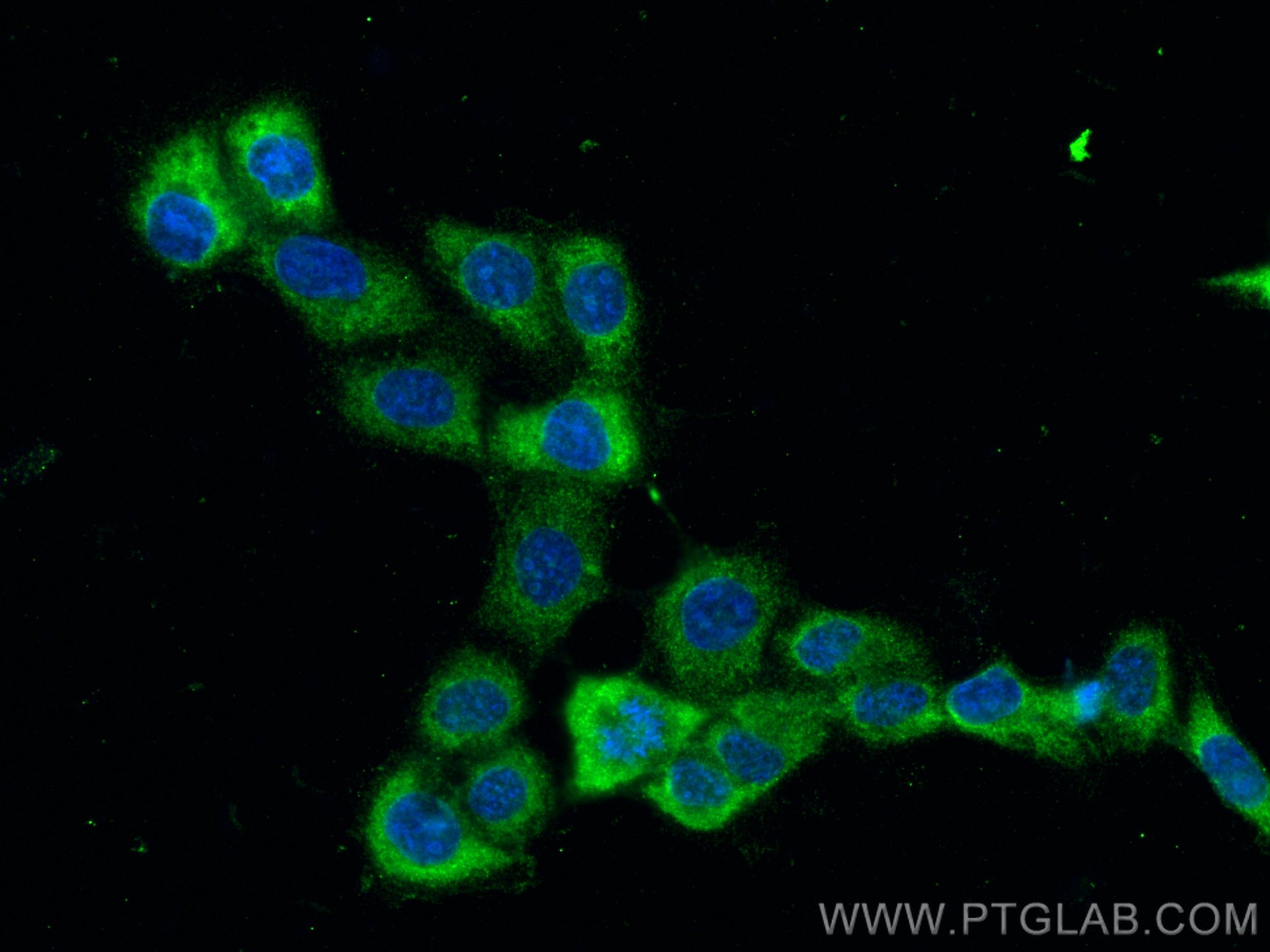 Immunofluorescence (IF) / fluorescent staining of A431 cells using ADC Monoclonal antibody (67884-1-Ig)
