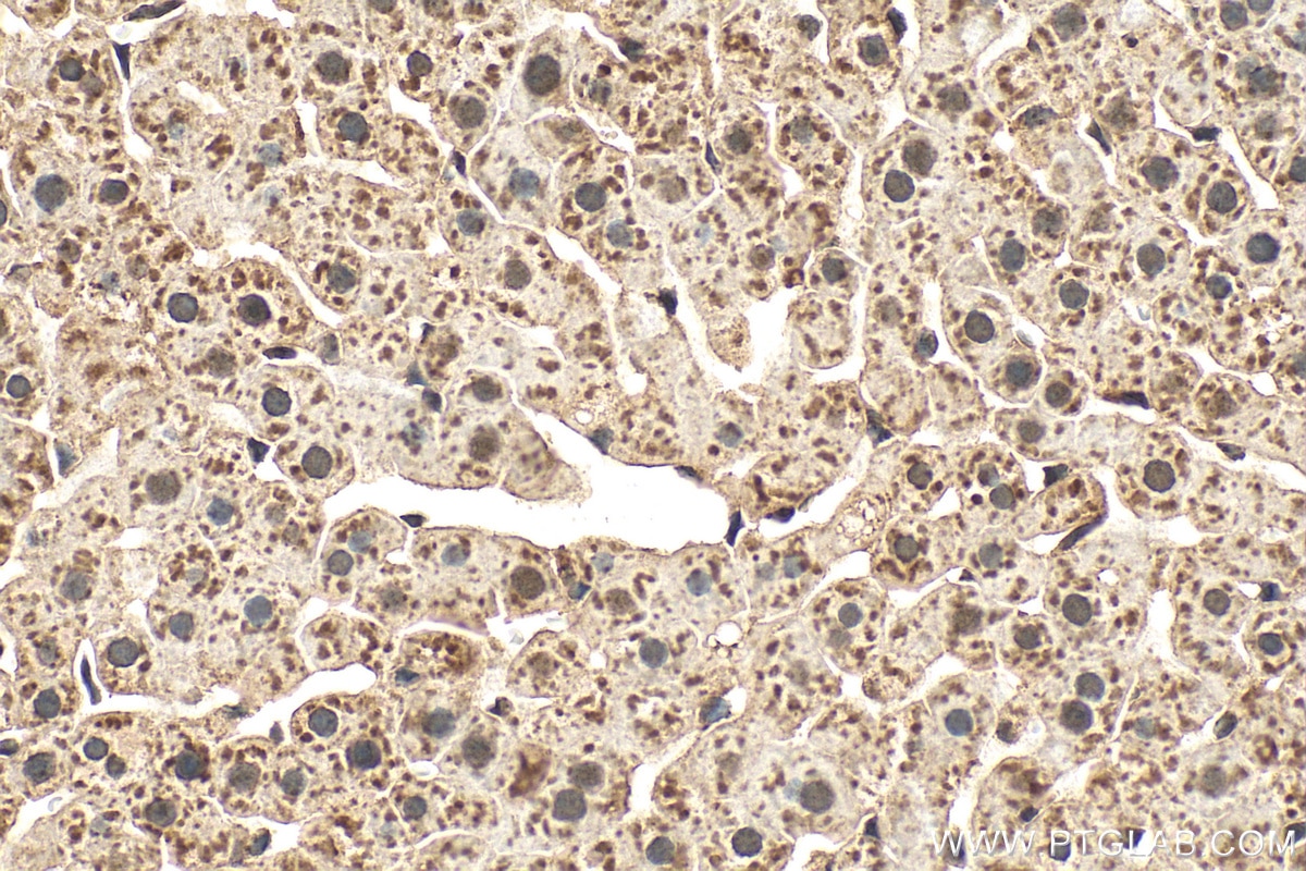 Immunohistochemistry (IHC) staining of rat liver tissue using ADC Monoclonal antibody (67884-1-Ig)