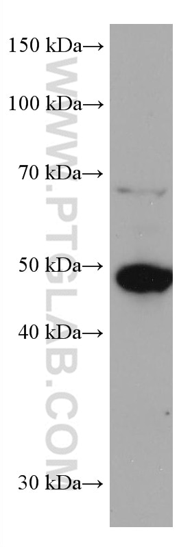 Western Blot (WB) analysis of HeLa cells using ADC Monoclonal antibody (67884-1-Ig)