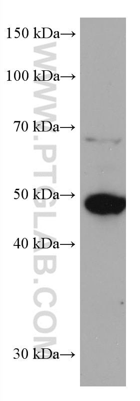 WB analysis of HeLa using 67884-1-Ig