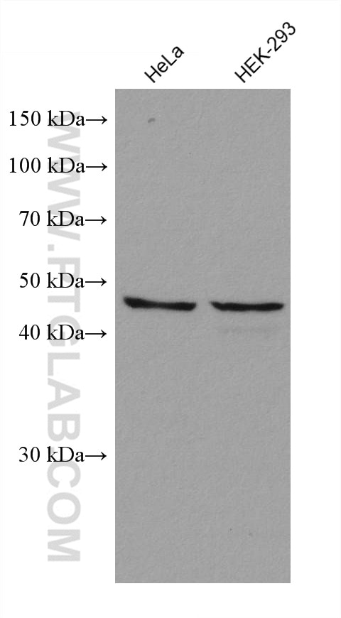 Western Blot (WB) analysis of various lysates using ADC Monoclonal antibody (67884-1-Ig)