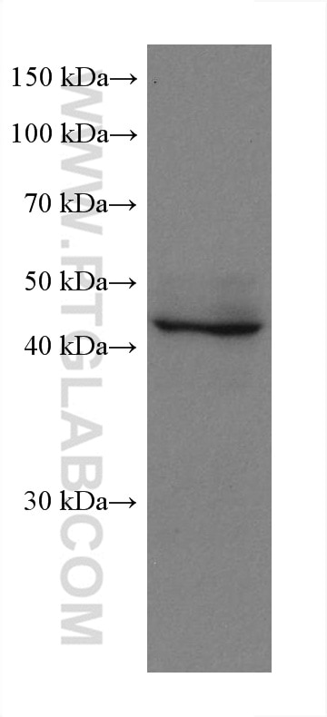 Western Blot (WB) analysis of mouse brain tissue using ADC Monoclonal antibody (67884-1-Ig)