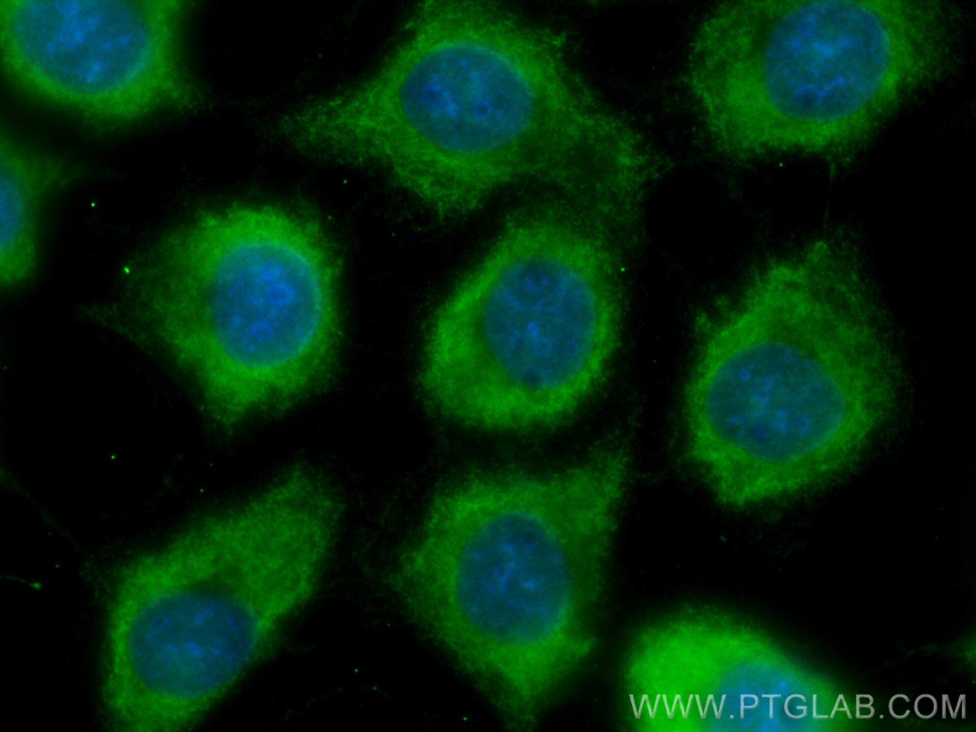 Immunofluorescence (IF) / fluorescent staining of A431 cells using CoraLite® Plus 488-conjugated ADC Monoclonal antib (CL488-67884)