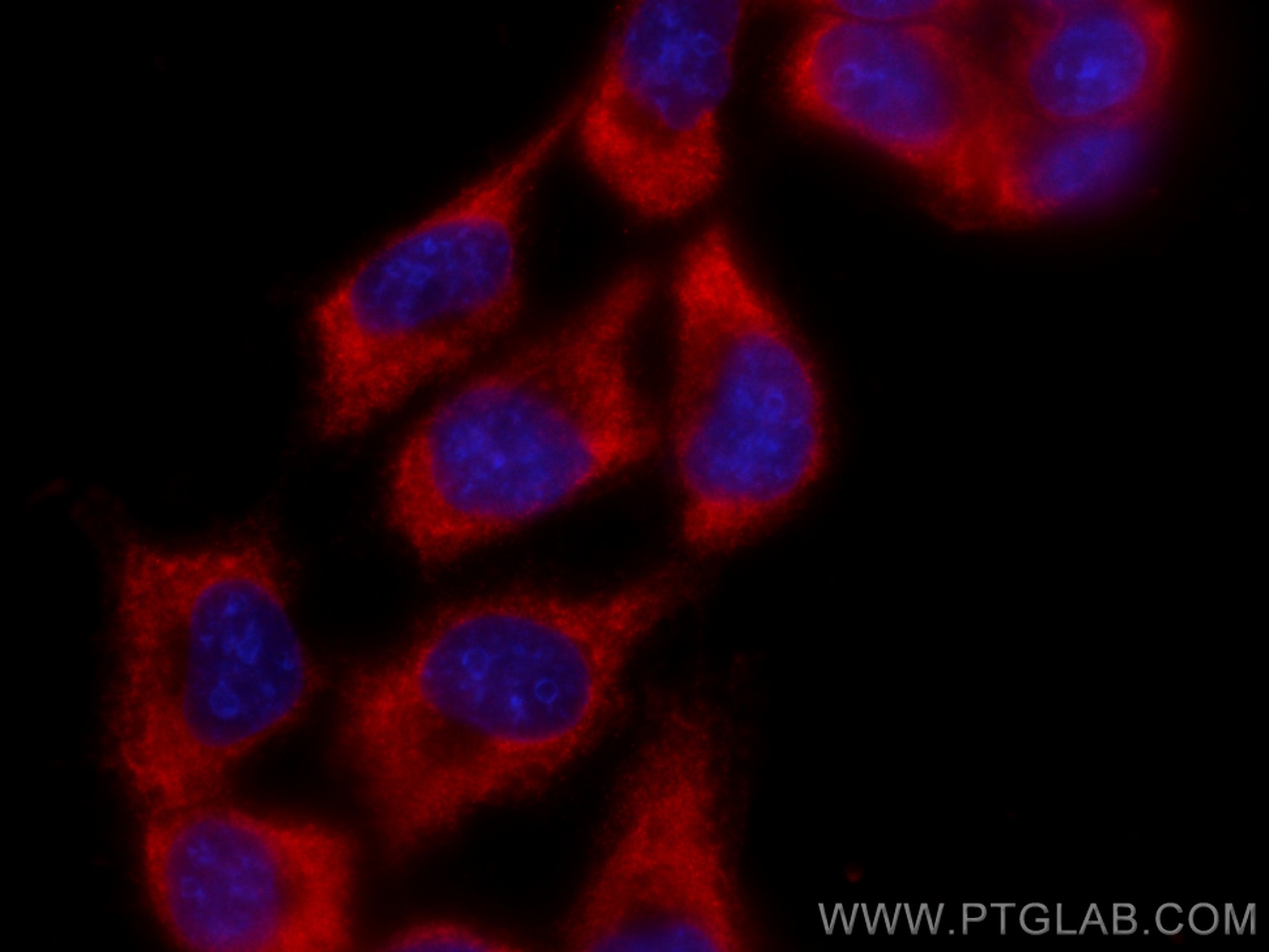 Immunofluorescence (IF) / fluorescent staining of A431 cells using CoraLite®594-conjugated ADC Monoclonal antibody (CL594-67884)