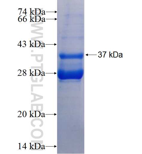 ADCK2 fusion protein Ag25945 SDS-PAGE