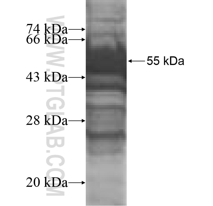 ADCK2 fusion protein Ag9338 SDS-PAGE