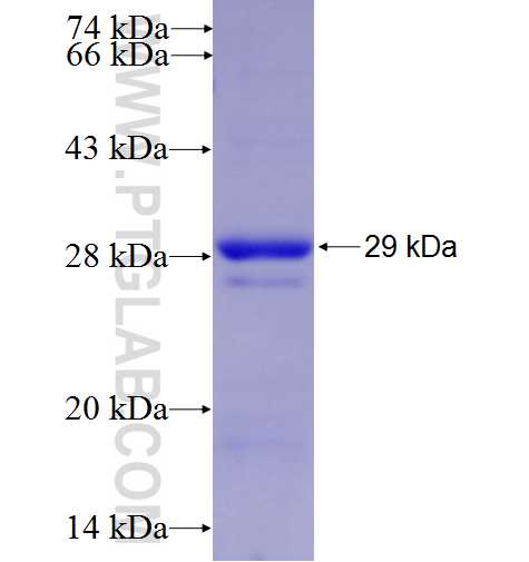 ADCK2 fusion protein Ag9379 SDS-PAGE