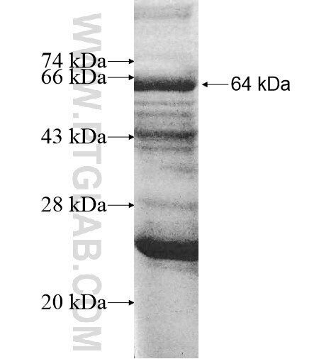 ADCK4 fusion protein Ag10776 SDS-PAGE