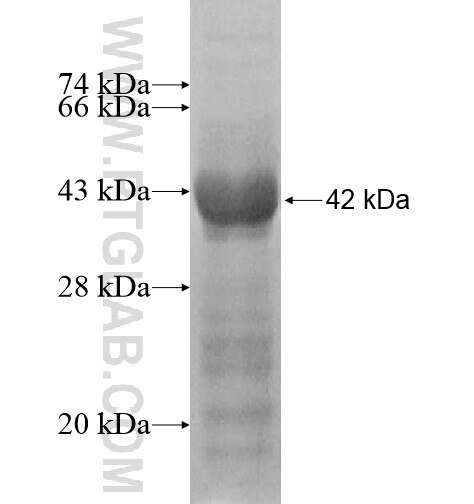 ADCK4 fusion protein Ag13188 SDS-PAGE