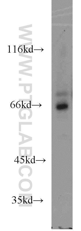 Western Blot (WB) analysis of mouse brain tissue using ADCK5 Polyclonal antibody (17579-1-AP)