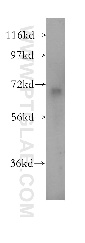 WB analysis of mouse brain using 17579-1-AP