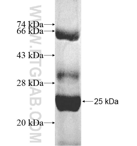 ADCK5 fusion protein Ag11094 SDS-PAGE