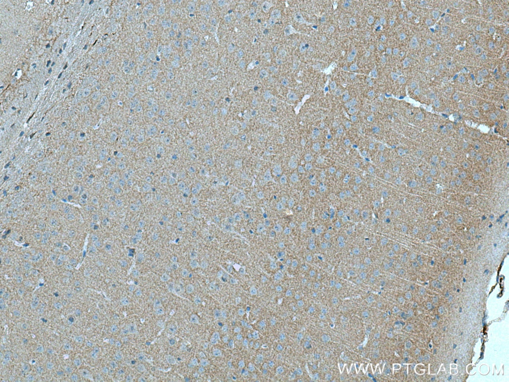 Immunohistochemistry (IHC) staining of mouse brain tissue using ADCY1 Polyclonal antibody (55067-1-AP)