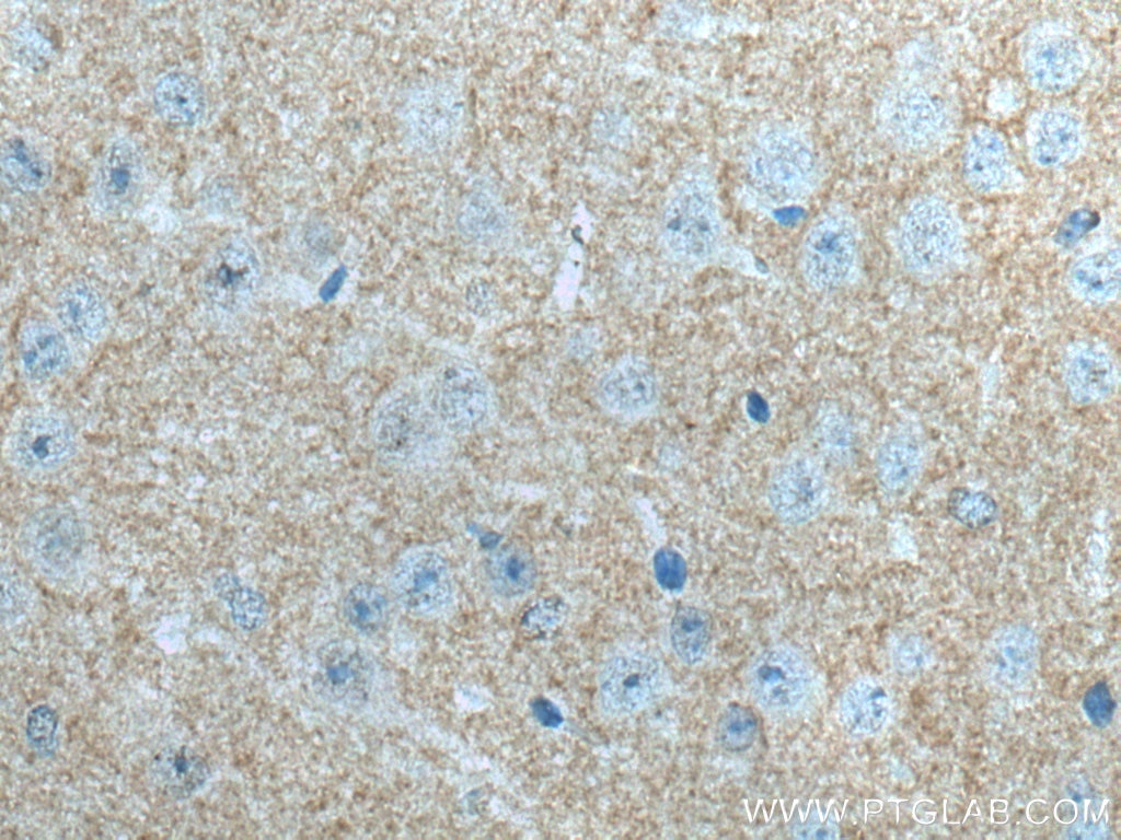 Immunohistochemistry (IHC) staining of mouse brain tissue using ADCY1 Polyclonal antibody (55067-1-AP)