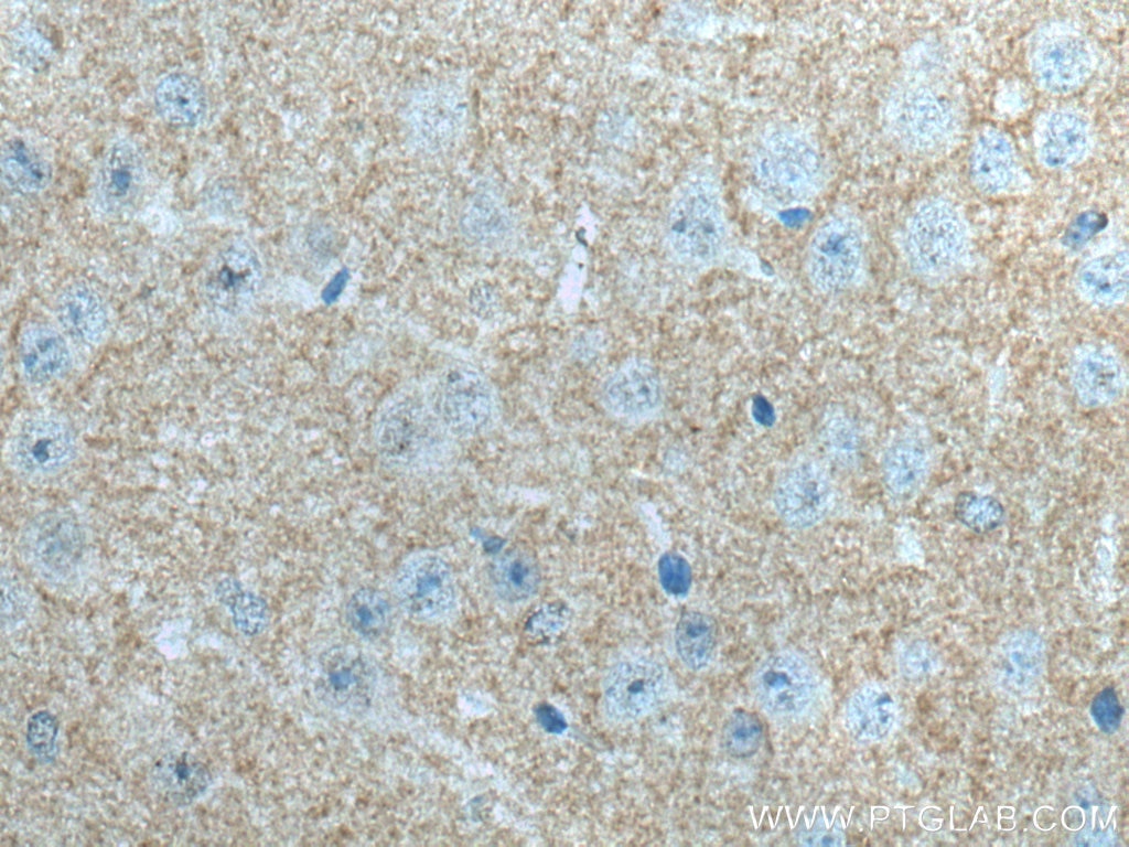 Immunohistochemistry (IHC) staining of mouse brain tissue using ADCY1 Polyclonal antibody (55067-1-AP)