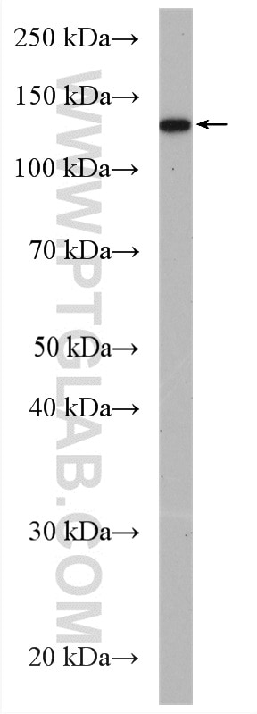 Western Blot (WB) analysis of SH-SY5Y cells using ADCY1 Polyclonal antibody (55067-1-AP)