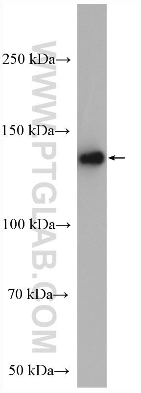 Western Blot (WB) analysis of SH-SY5Y cells using ADCY1 Polyclonal antibody (55067-1-AP)