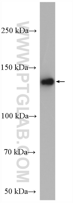 WB analysis of SH-SY5Y using 55067-1-AP