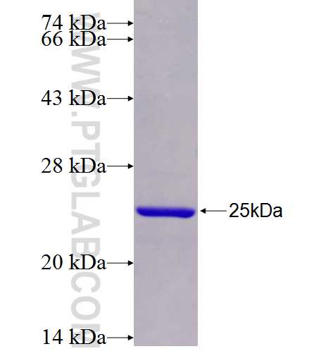 ADCY2 fusion protein Ag26455 SDS-PAGE