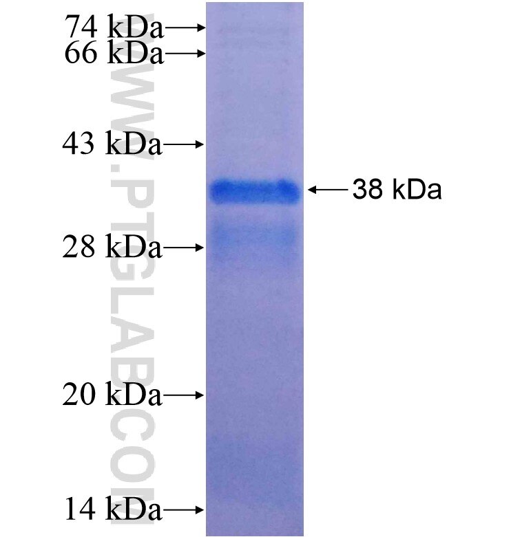 ADCY2 fusion protein Ag16210 SDS-PAGE