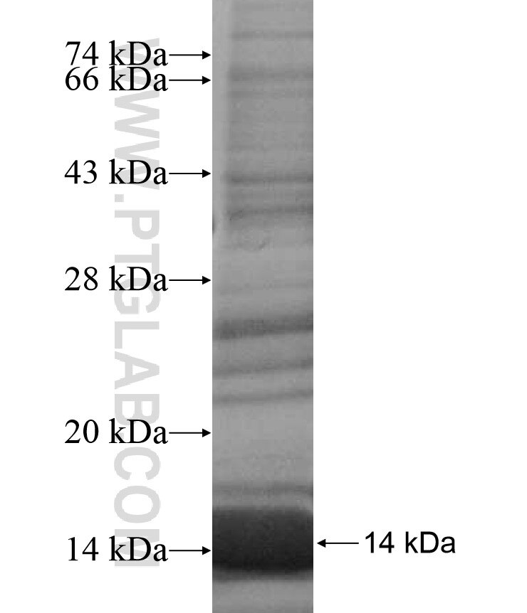 ADCY2 fusion protein Ag17010 SDS-PAGE