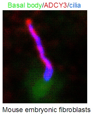 Immunofluorescence (IF) / fluorescent staining of Mouse embryonic fibroblasts using ADCY3 Polyclonal antibody (19492-1-AP)