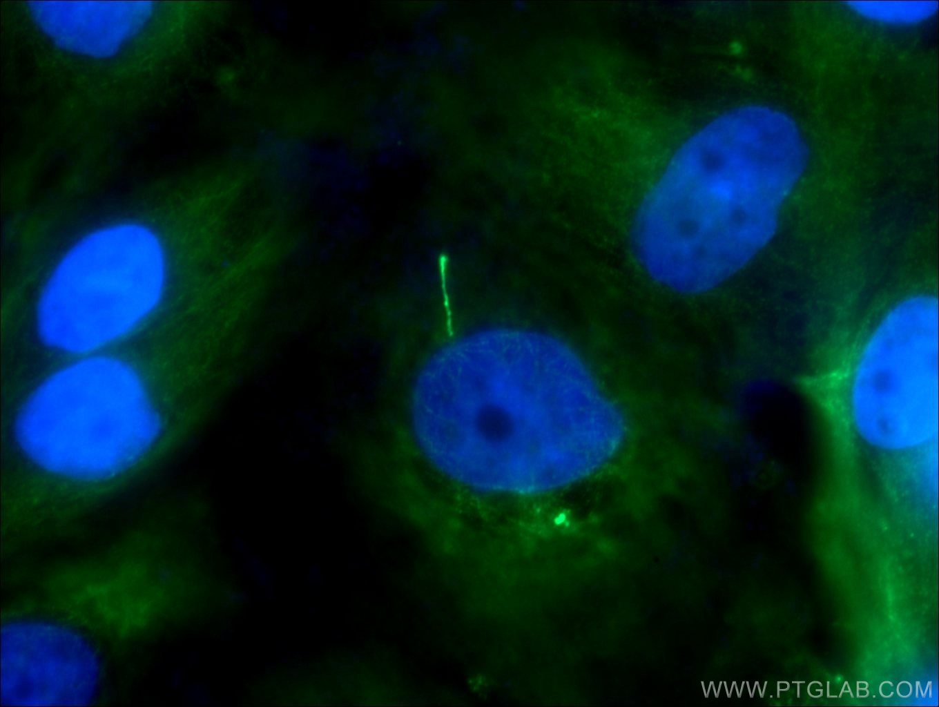 Immunofluorescence (IF) / fluorescent staining of MDCK cells using ADCY3 Polyclonal antibody (19492-1-AP)
