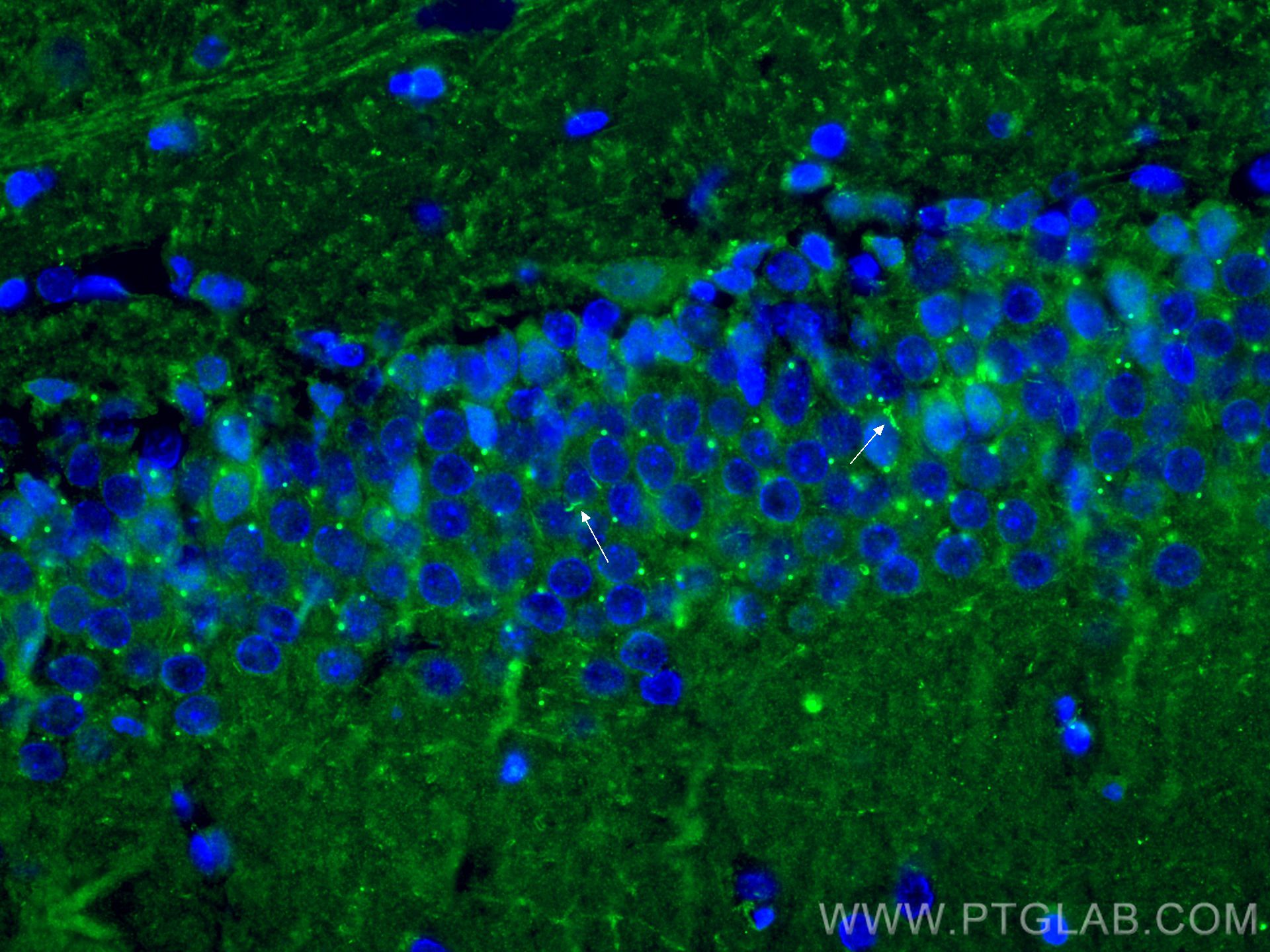 Immunofluorescence (IF) / fluorescent staining of rat brain tissue using ADCY3 Polyclonal antibody (19492-1-AP)