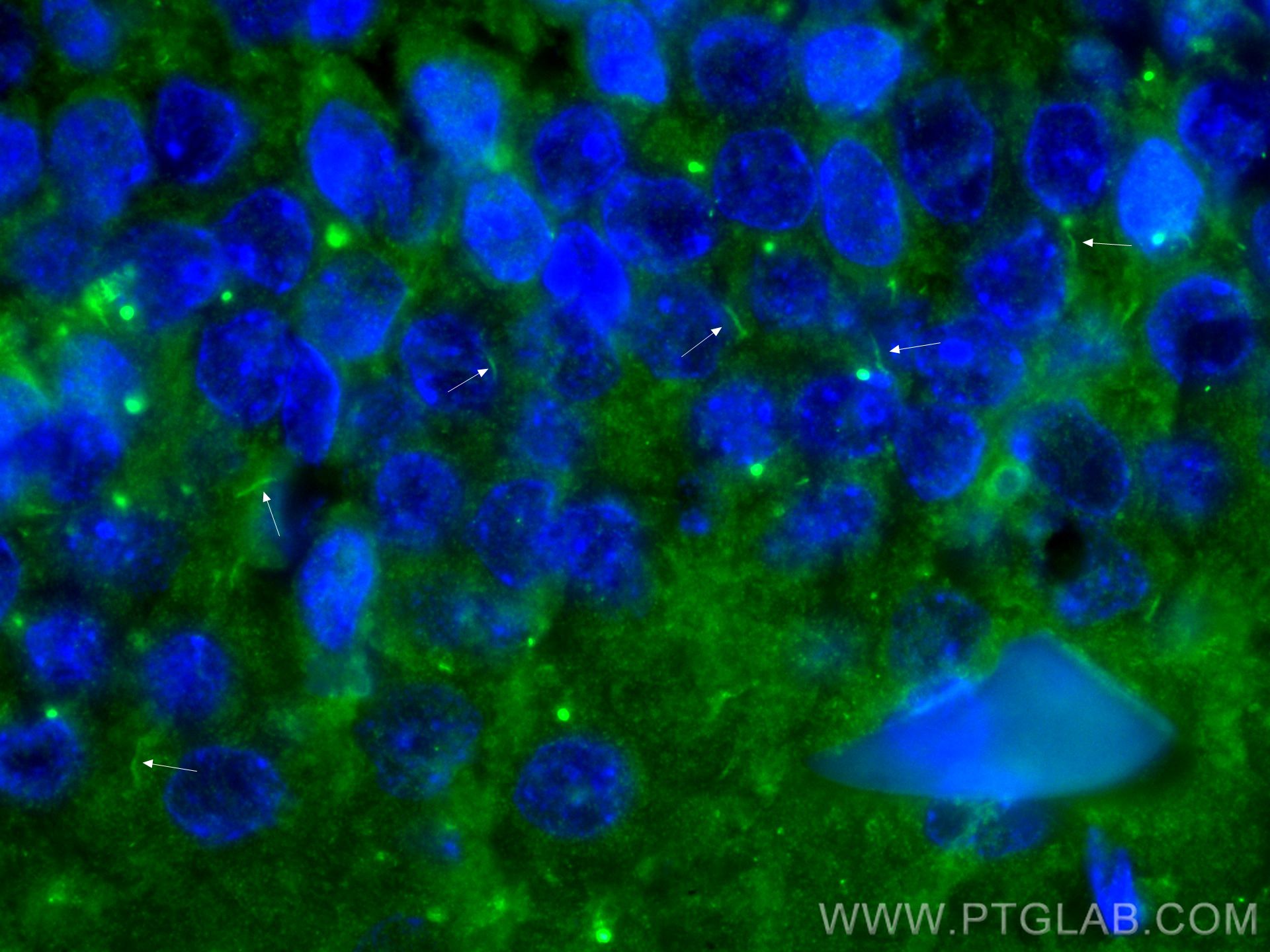 Immunofluorescence (IF) / fluorescent staining of rat brain tissue using ADCY3 Polyclonal antibody (19492-1-AP)