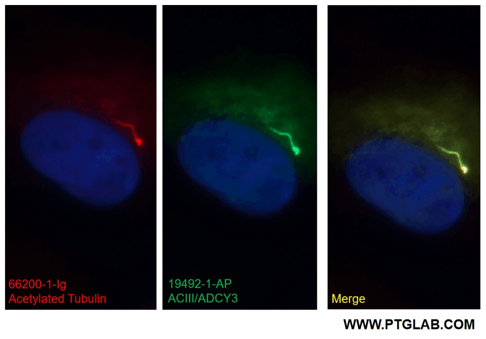Immunofluorescence (IF) / fluorescent staining of MDCK cells using ADCY3 Polyclonal antibody (19492-1-AP)