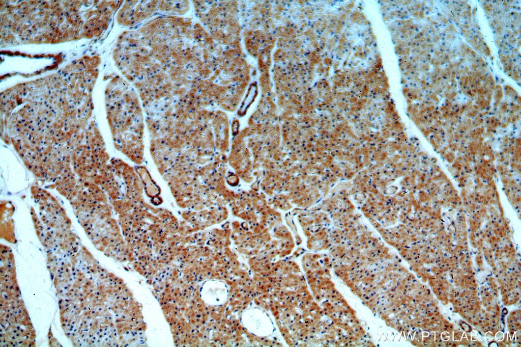 Immunohistochemistry (IHC) staining of human heart tissue using ADCY3 Polyclonal antibody (19492-1-AP)