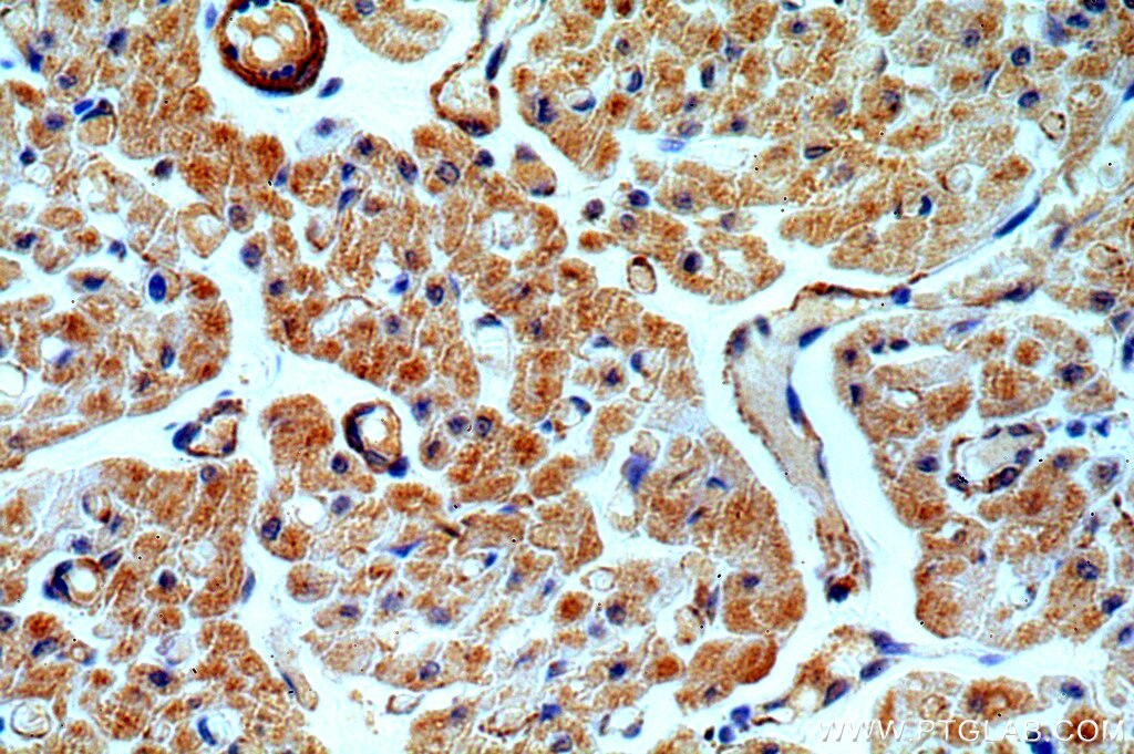 IHC staining of human heart using 19492-1-AP