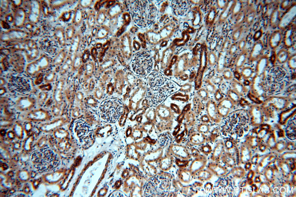 Immunohistochemistry (IHC) staining of human kidney tissue using ADCY3 Polyclonal antibody (19492-1-AP)