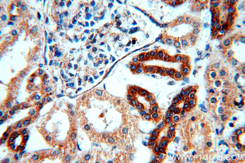 IHC staining of human kidney using 19492-1-AP