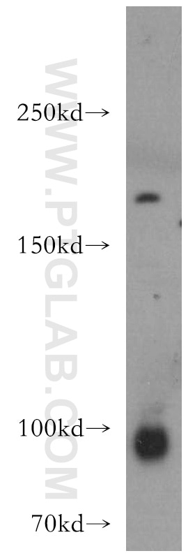 Western Blot (WB) analysis of human brain tissue using ADCY3 Polyclonal antibody (19492-1-AP)