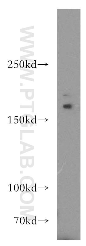 Western Blot (WB) analysis of mouse skeletal muscle tissue using ADCY3 Polyclonal antibody (19492-1-AP)