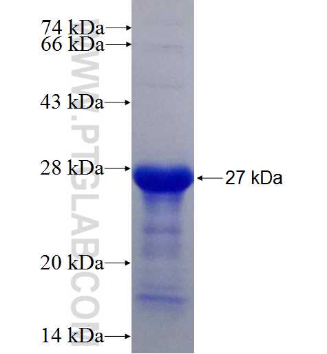 ADCY3 fusion protein Ag25859 SDS-PAGE