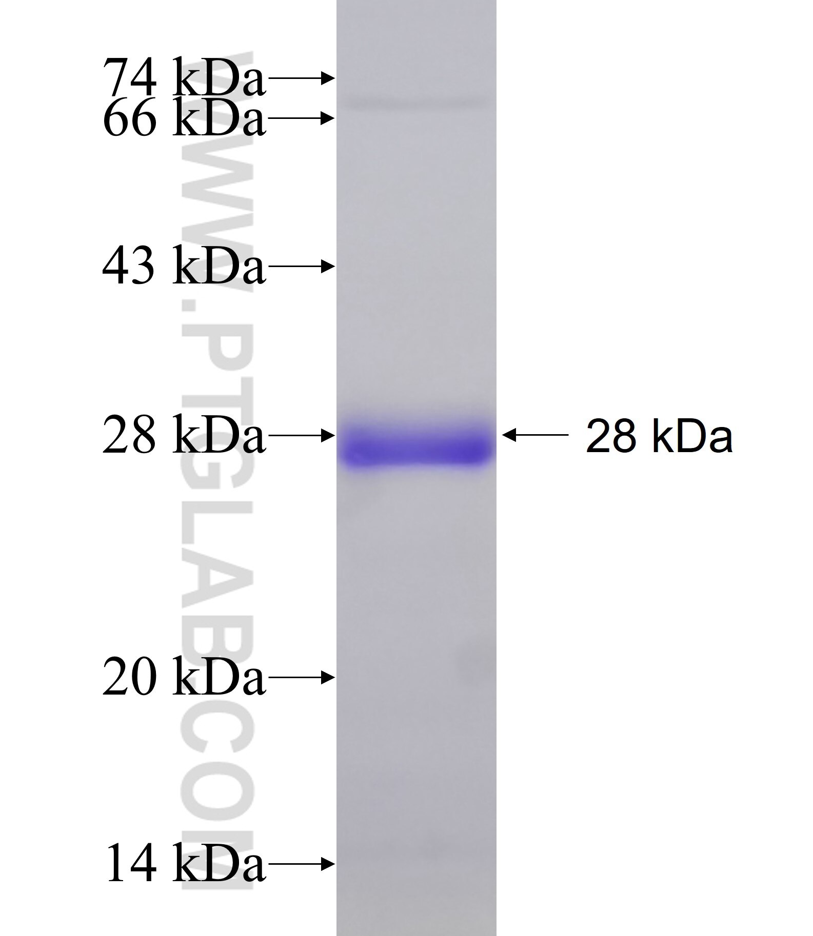 ADCY3 fusion protein Ag25859 SDS-PAGE