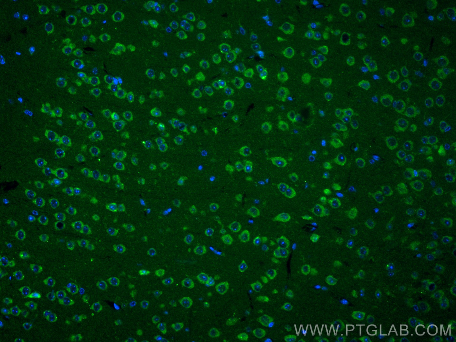 Immunofluorescence (IF) / fluorescent staining of mouse brain tissue using ADCY5 Polyclonal antibody (30153-1-AP)