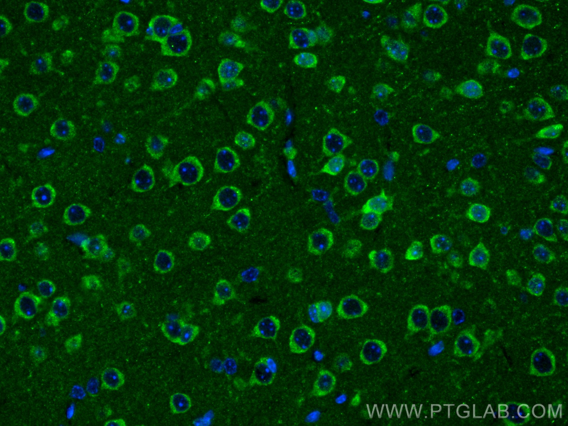 Immunofluorescence (IF) / fluorescent staining of mouse brain tissue using ADCY5 Polyclonal antibody (30153-1-AP)