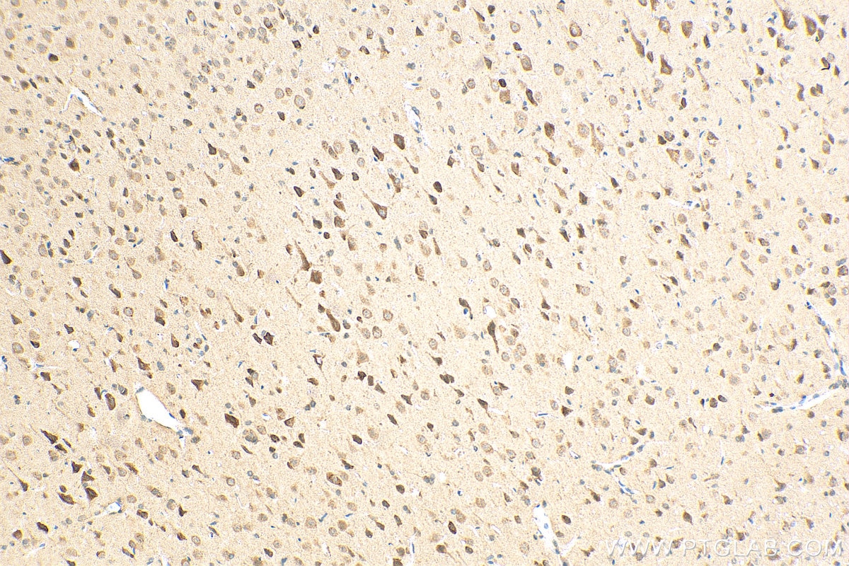 Immunohistochemistry (IHC) staining of rat brain tissue using ADCY5 Polyclonal antibody (30153-1-AP)