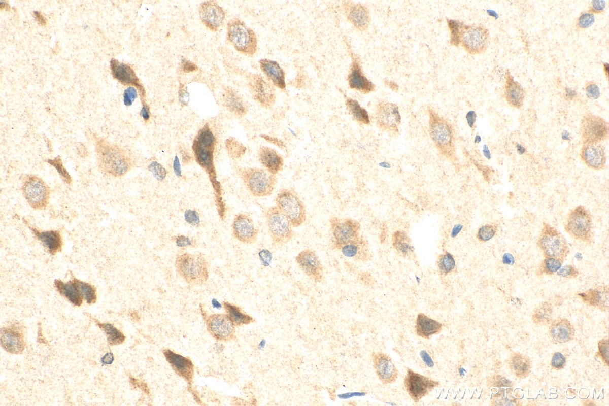 Immunohistochemistry (IHC) staining of rat brain tissue using ADCY5 Polyclonal antibody (30153-1-AP)