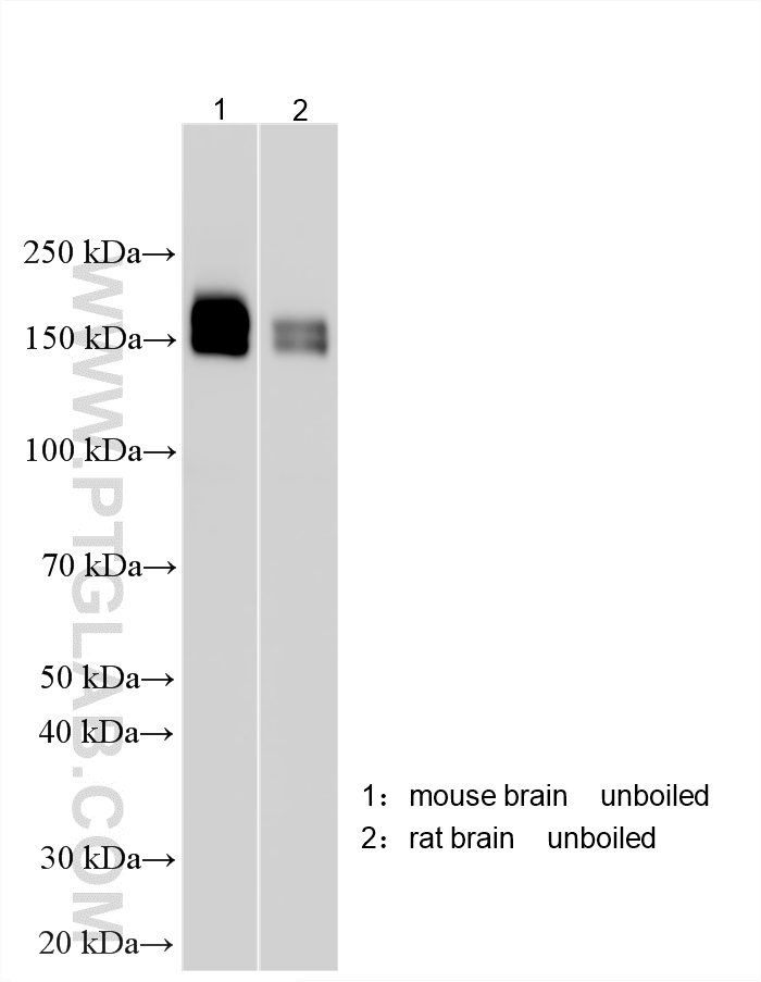 WB analysis using 30153-1-AP (same clone as 30153-1-PBS) Western Blot (WB) analysis of various lysates using ADCY5 Polyclonal antibody (30153-1-AP)