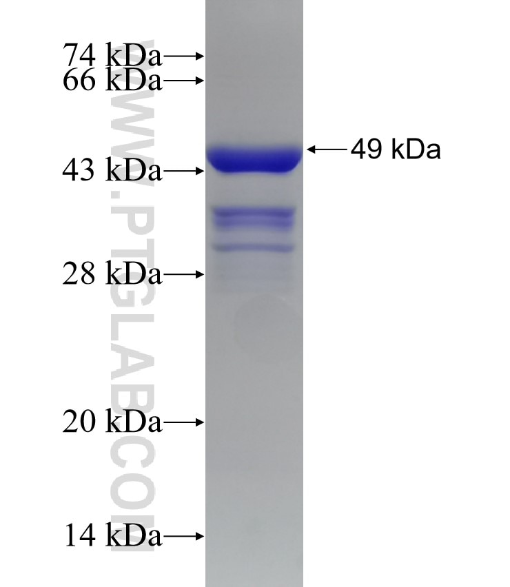 ADCY5 fusion protein Ag32812 SDS-PAGE